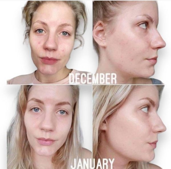 The ordinary niacinamide serum 30 ml - Image 4