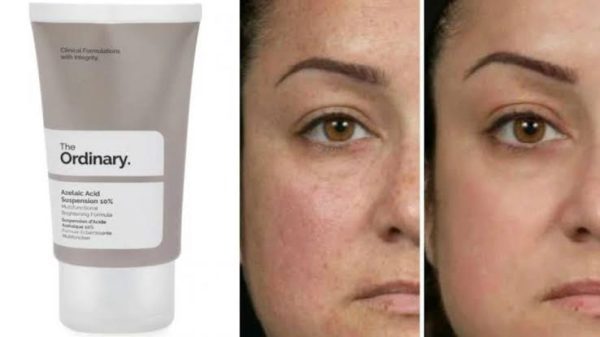 The Ordinary Azelaic Acid Suspension 10%  30 ml - Image 2