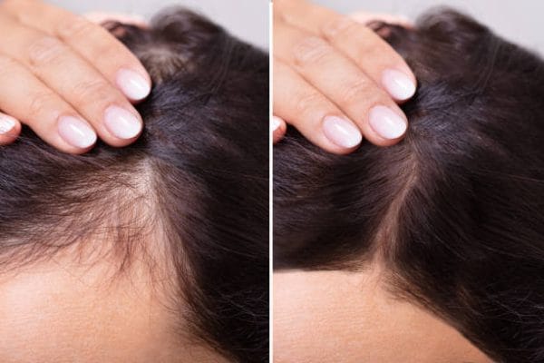The Ordinary Multi-Peptide Serum for Hair Density 60 ml - Image 4