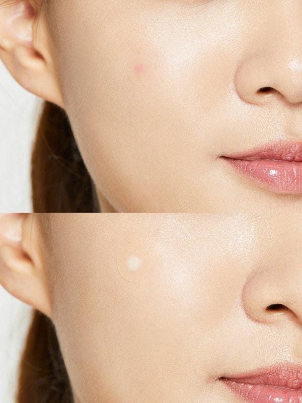 Cosrx Acne Pimple Master Patch - Image 2
