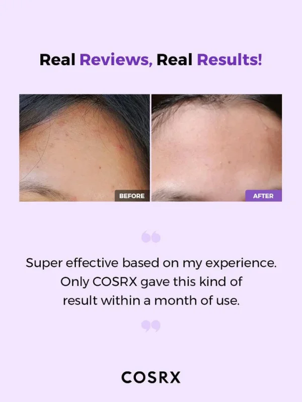 Cosrx AHA/BHA Clarifying Treatment Toner - Image 6