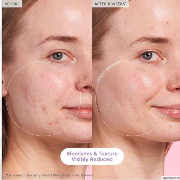 Glow Recipe Blackberry Retinol Blemish Serum 30 Ml - Image 4
